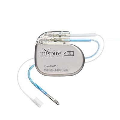 Inspire implant device