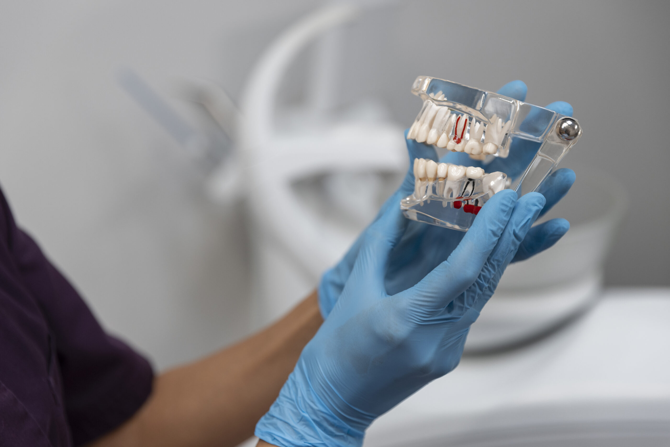 Zygomatic Implants — DFWOMS