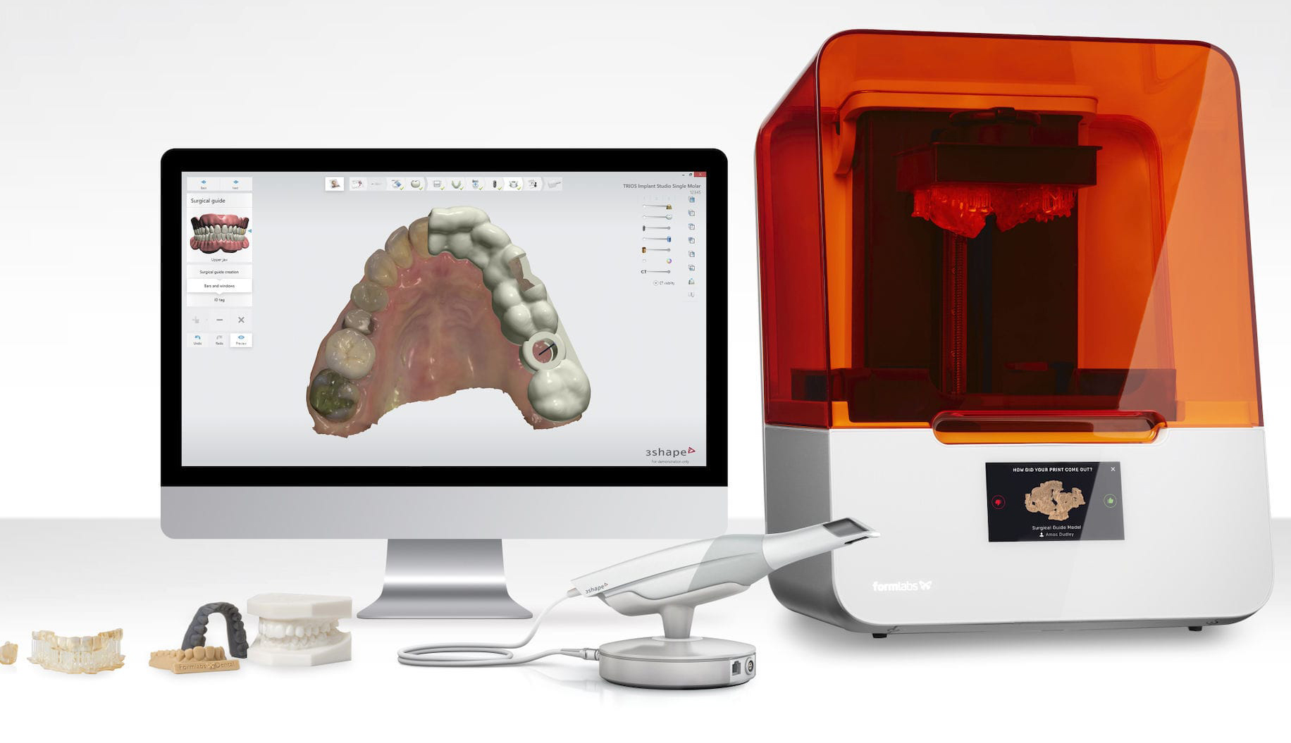 Esc&aacute;ner Intraoral e Impresi&oacute;n 3D en Consultorios &mdash; DFWOMS